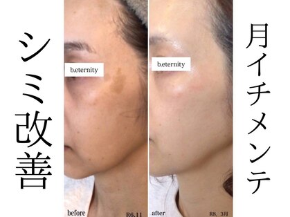 ビエタニティ(b.eternity)の写真