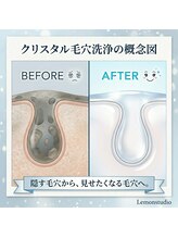 レモンスタジオ 秩父店/韓国式クリスタル毛穴洗浄