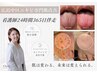 【何をしても繰り返すニキビ】原因がわからない方のための看護師無料相談90分