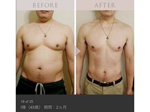 ジェニックサロン グランドギンザ ひたちなか(GENIC SALON GRAND GINZA)/フェリーチェの徐脂肪プログラム