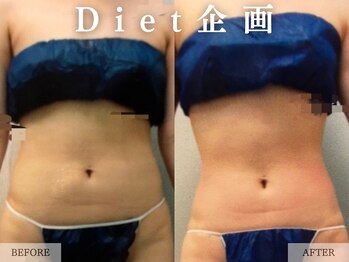 レヴェリー 心斎橋店(REVERIE)/Diet 企画