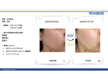 リトルーム(Litroom: from Seoul)/スキンメイド