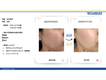 リトルーム(Litroom: from Seoul)/スキンメイド