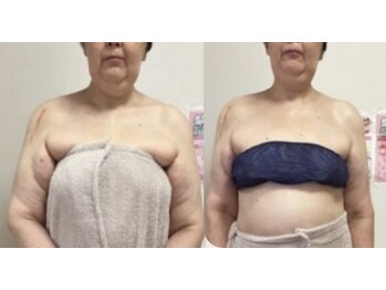 サロンペタル 浦安(Salon Petal)/上半身スリム