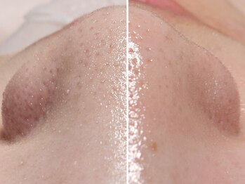 ユウビジン(YOU美人)/