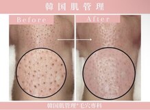 ビュークロ 三軒茶屋店(viewQLO)