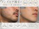 シュガーリングハウス ベル(Bell)の写真