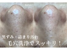 カンパニュラ(campanula)の雰囲気（30代～60代のお客様多数ご来店！毛穴・改善ダントツ人気店！）