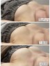【サイズ悩み★お胸を育てる】オールハンド育乳施術で憧れ谷間！33000→8800