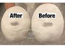 美極 トータルビューティー(美極 TOTAL BEAUTY)/恵比寿/小顔コルギ/エステ/