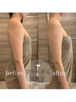 ビアージュ ナガクテ(Beage nagakute)/ブライダルエステもやっています