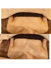 IBC 上大岡店/Before-After