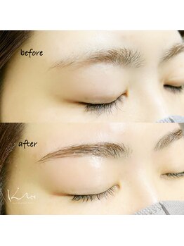 クレー(Klee)/アイブロウリフト