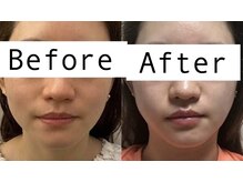 ムーンライズ(moonrise)/