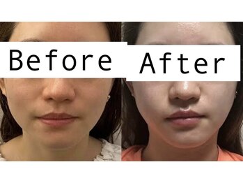 ムーンライズ(moonrise)/