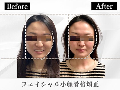ポーベルポー(Peau Belle poe)の写真