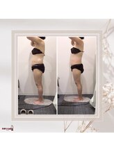 効くラボ 梅田店/1ヶ月でこの変化