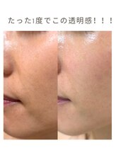 ルソール(Le seul)/1day透明水光肌☆