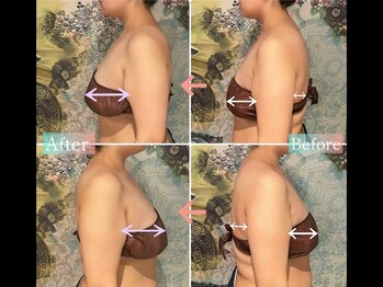 サザンベル(Southern Belle)/