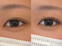 ループ(LOOP)/まつ毛before→after