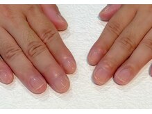 レイス(LEISS)/クリアネイル