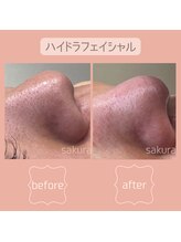 ビューティブロス(Beauty Bros)/