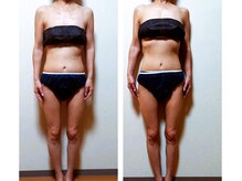 ピエリ ザ ビューティステイション 春日原店(Pierie THE BEAUTY STATION)/全身のむくみに