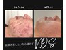 V.O.Sサロンケア 11,000円（税込) 60分