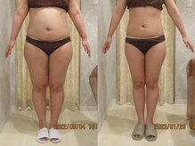 プロラボスパ 渋谷店/20代後半　症例写真