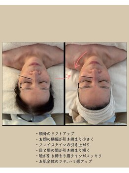 サロン シエラ/施術1回　60代