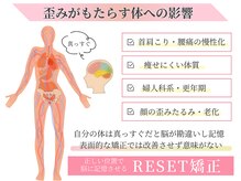 体の歪み改善から小顔まで叶える全身矯正◎