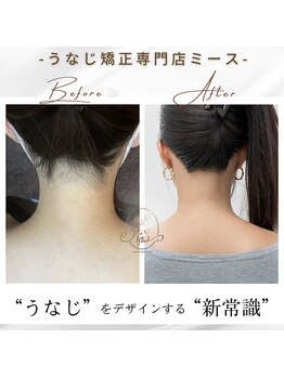 ミース 北九州店/うなじ△ビフォーアフター