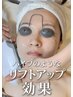 顎下バチバチ★