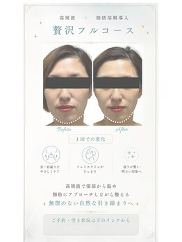 エフリア 大垣(F.lia)/ぼやけたフェイスラインがキュッ