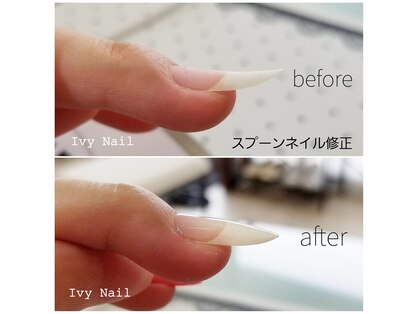 アイビーネイル(Ivy Nail)の写真