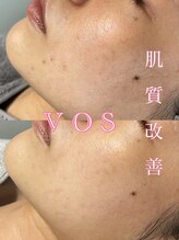 ティアーナ(Tiaana)/肌質改善VOSサロンケア