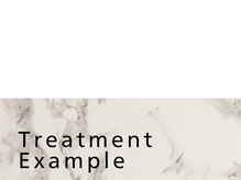 トランザット 六本木店(TransATT)/メンズフェイシャル/ヘッドスパ