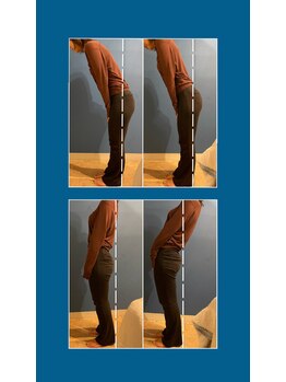 アディクト(Addict)/Before＆After