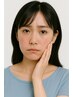 【OPEN記念】美重鍼(美容鍼)◆ニキビ・肌荒れケア◆60分コース ¥14000→8000