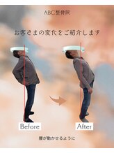 ABC整体院/腰痛整体のビフォーアフター