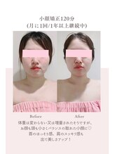 トゥインクル 麻布(twinkle)/南麻布/シンメトリー小顔矯正