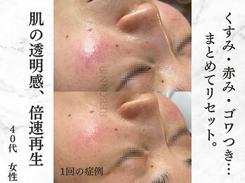 リボーン 柏(REBORN)/光フォトで均一な明るさを纏う