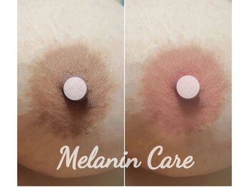 ペキュリア 恵比寿店(PEQLIA)/最新の黒ずみケアで乳輪ケア♪