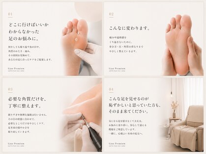 リノ プレミアム(Lino Premium)の写真