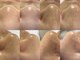 フェリス(FELIZ)の写真/《毛穴レスキュー参上》夏直前!その毛穴どうする?隠せない季節始まってます☆手遅れ前に夏肌リセット◎