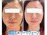 【次世代サーマウェーブ】韓流女優のような小顔へ!!医療提携で効果を実感♪