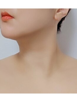 エクラ(e'clat)の写真/最新マシン使用で効果実感！憧れの小顔を実現いたします♪ほうれい線・目の開き・たるみ改善にも◎