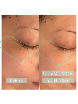 グラント ふじみ野店(grant)/