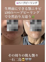 リツイート(ReTweet)/ハーブピーリング・艶・くすみ