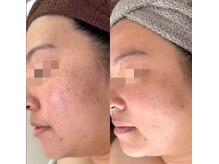 アンベリール(Embellir)/Embellir